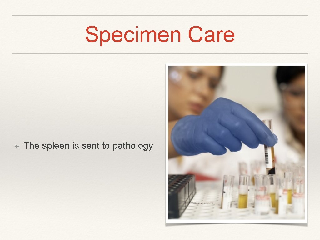 Specimen Care ❖ The spleen is sent to pathology 