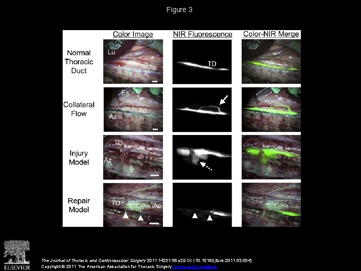 Figure 3 The Journal of Thoracic and Cardiovascular Surgery 2011 14231 -38. e 2
