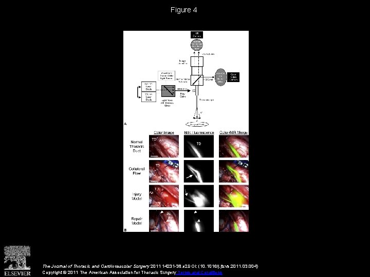 Figure 4 The Journal of Thoracic and Cardiovascular Surgery 2011 14231 -38. e 2