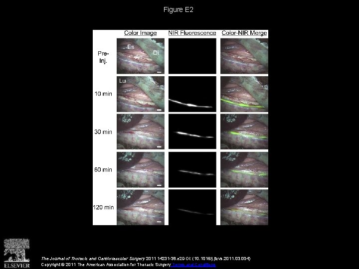 Figure E 2 The Journal of Thoracic and Cardiovascular Surgery 2011 14231 -38. e