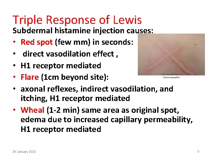 Triple Response of Lewis Subdermal histamine injection causes: • Red spot (few mm) in