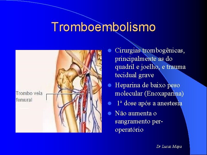 Tromboembolismo Cirurgias trombogênicas, principalmente as do quadril e joelho, e trauma tecidual grave l