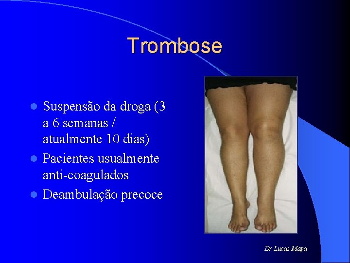 Trombose Suspensão da droga (3 a 6 semanas / atualmente 10 dias) l Pacientes