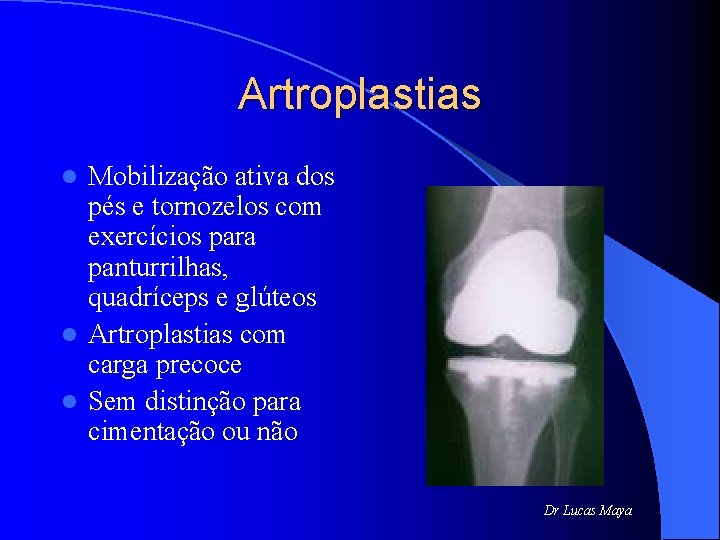 Artroplastias Mobilização ativa dos pés e tornozelos com exercícios para panturrilhas, quadríceps e glúteos