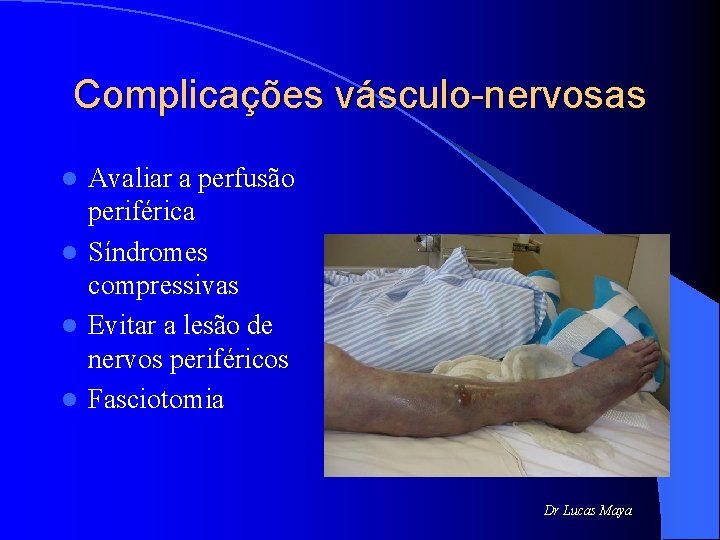 Complicações vásculo-nervosas Avaliar a perfusão periférica l Síndromes compressivas l Evitar a lesão de