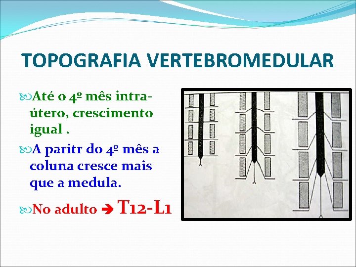 TOPOGRAFIA VERTEBROMEDULAR Até o 4º mês intraútero, crescimento igual. A paritr do 4º mês