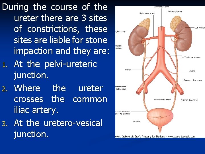 During the course of the ureter there are 3 sites of constrictions, these sites