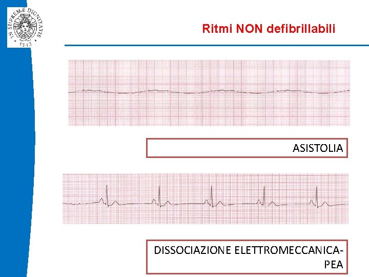 Ritmi NON defibrillabili ASISTOLIA DISSOCIAZIONE ELETTROMECCANICAPEA 