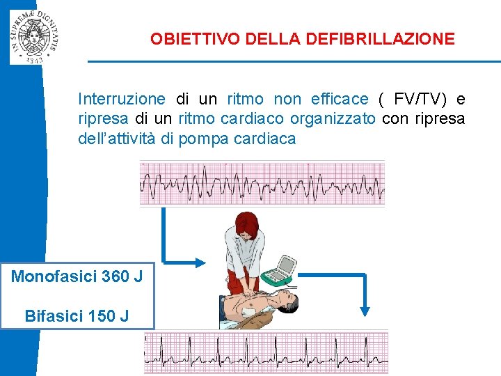 OBIETTIVO DELLA DEFIBRILLAZIONE Interruzione di un ritmo non efficace ( FV/TV) e ripresa di