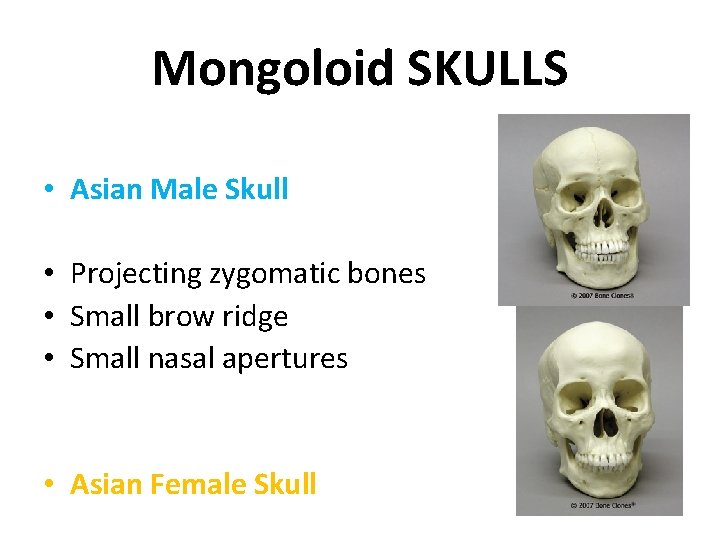 Mongoloid SKULLS • Asian Male Skull • Projecting zygomatic bones • Small brow ridge