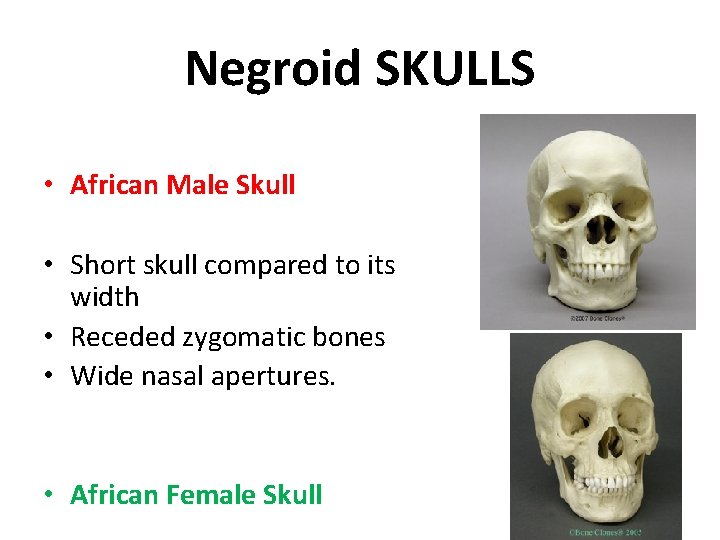 Negroid SKULLS • African Male Skull • Short skull compared to its width •