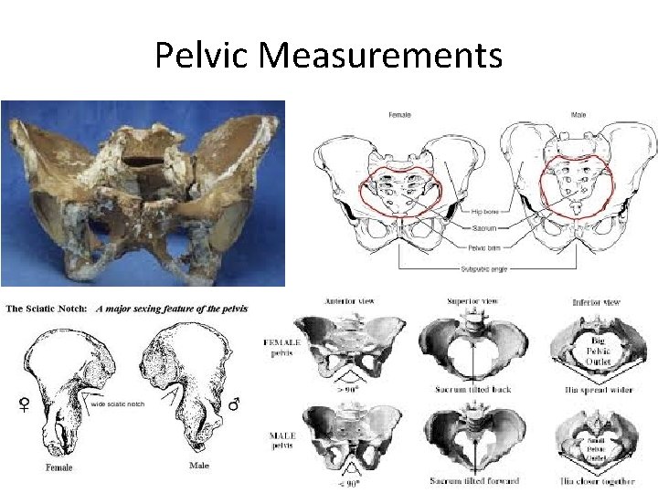 Pelvic Measurements 