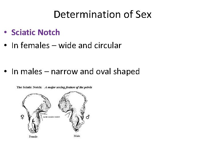 Determination of Sex • Sciatic Notch • In females – wide and circular •