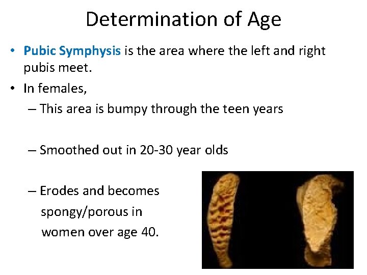 Determination of Age • Pubic Symphysis is the area where the left and right