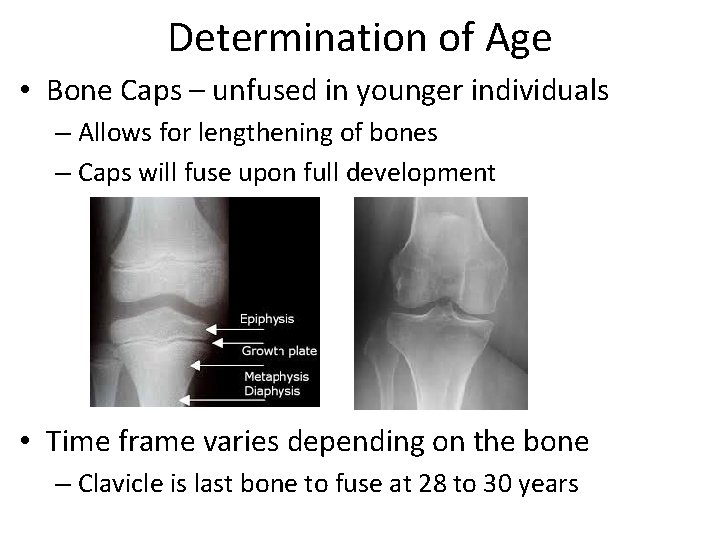 Determination of Age • Bone Caps – unfused in younger individuals – Allows for