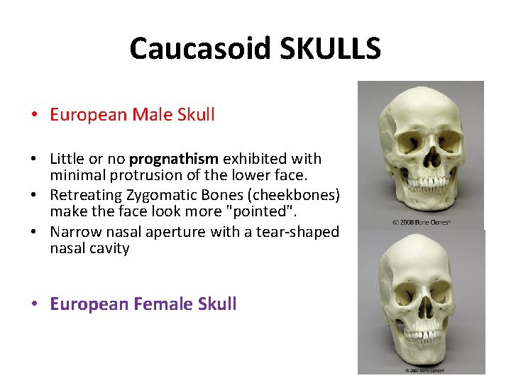 Caucasoid SKULLS • European Male Skull • Little or no prognathism exhibited with minimal