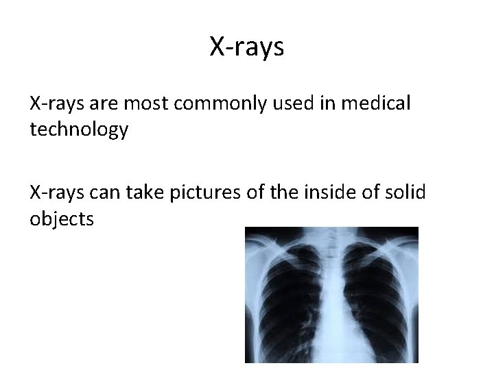 X-rays are most commonly used in medical technology X-rays can take pictures of the