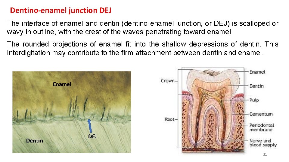 Dentino-enamel junction DEJ The interface of enamel and dentin (dentino-enamel junction, or DEJ) is