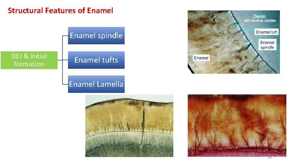 Structural Features of Enamel spindle DEJ & initial formation Enamel tufts Enamel Lamella 23