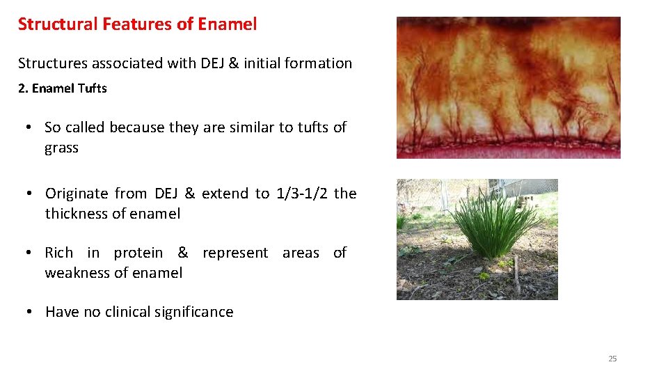 Structural Features of Enamel Structures associated with DEJ & initial formation 2. Enamel Tufts