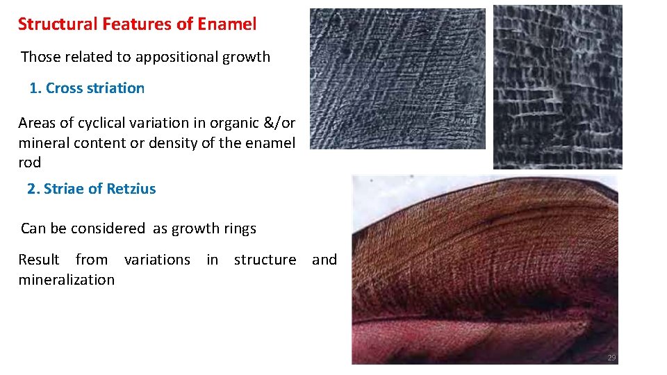 Structural Features of Enamel Those related to appositional growth 1. Cross striation Areas of