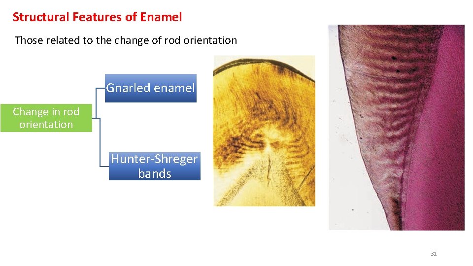 Structural Features of Enamel Those related to the change of rod orientation Gnarled enamel