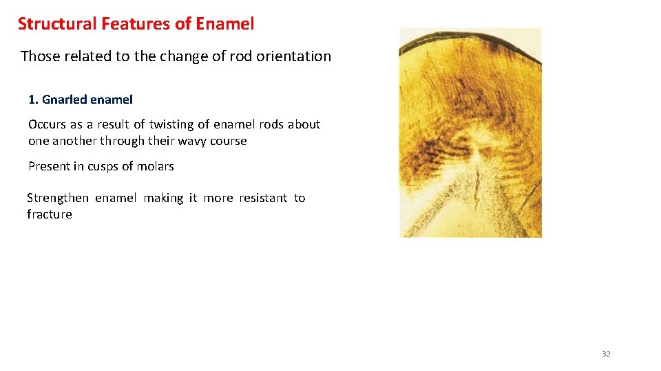 Structural Features of Enamel Those related to the change of rod orientation 1. Gnarled