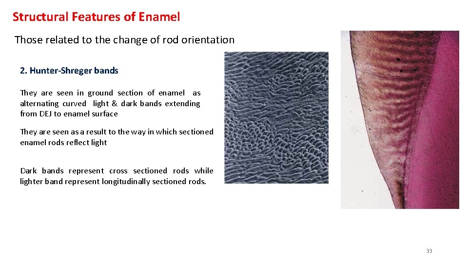 Structural Features of Enamel Those related to the change of rod orientation 2. Hunter-Shreger