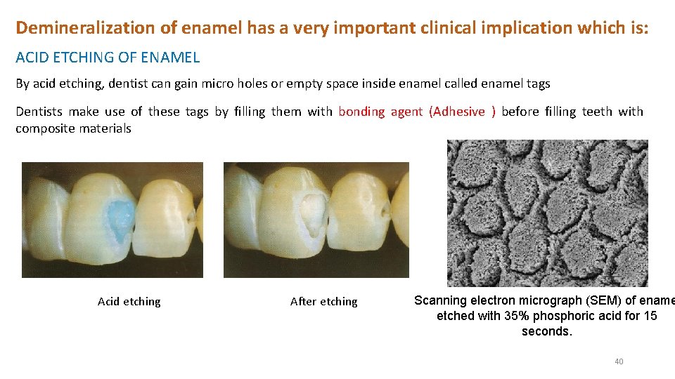 Demineralization of enamel has a very important clinical implication which is: ACID ETCHING OF