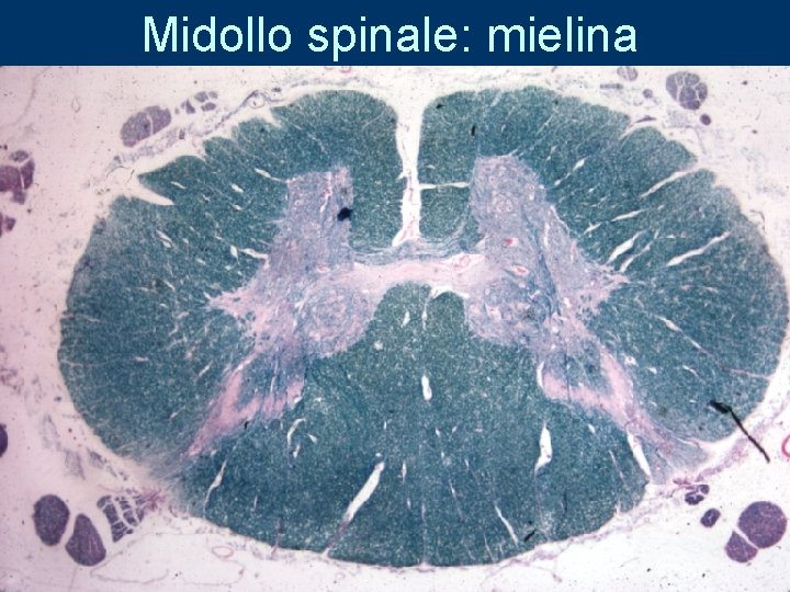 Midollo spinale: mielina 