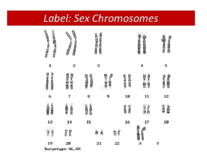 Label: Sex Chromosomes 