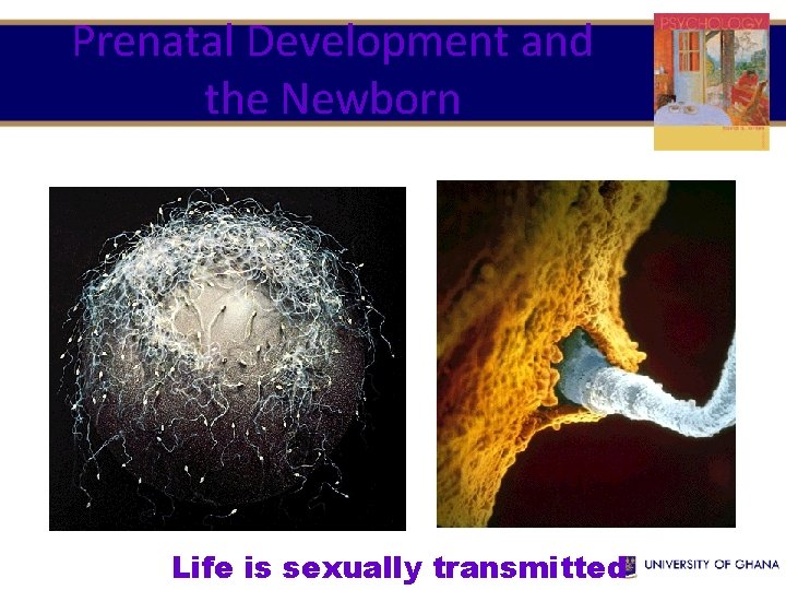 Prenatal Development and the Newborn Life is sexually transmitted 