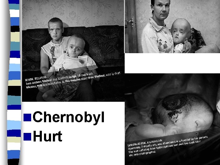 n. Chernobyl n. Hurt 