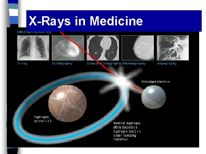 X-Rays in Medicine 