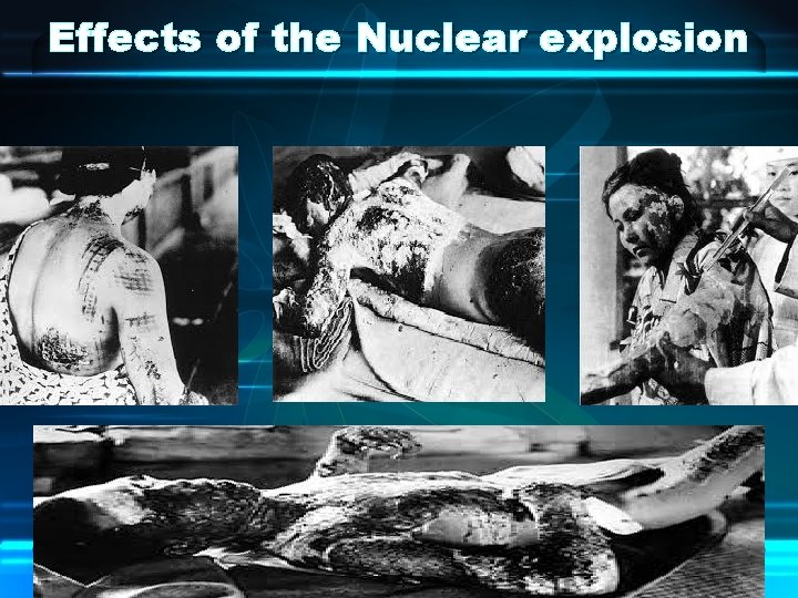 Effects of the Nuclear explosion 