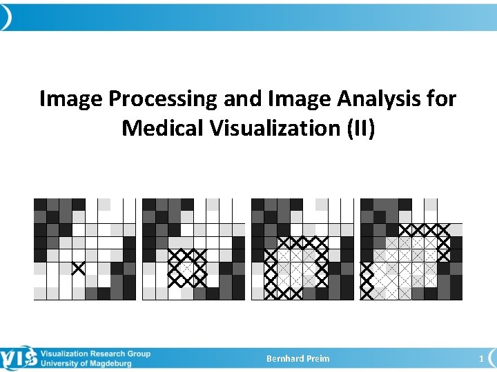 Image Processing and Image Analysis for Medical Visualization (II) Bernhard Preim 1 