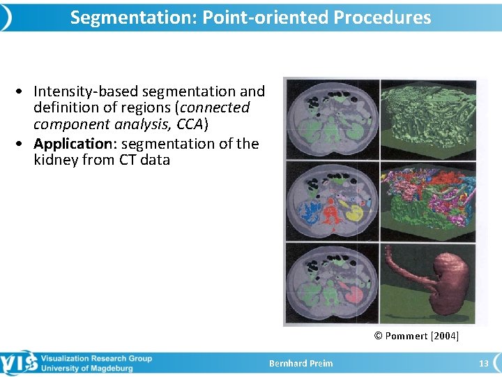 Segmentation: Point-oriented Procedures • Intensity-based segmentation and definition of regions (connected component analysis, CCA)