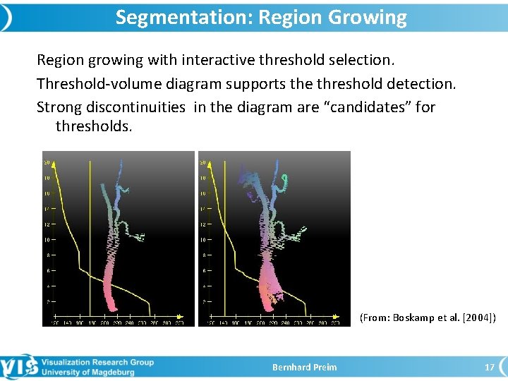 Segmentation: Region Growing Region growing with interactive threshold selection. Threshold-volume diagram supports the threshold