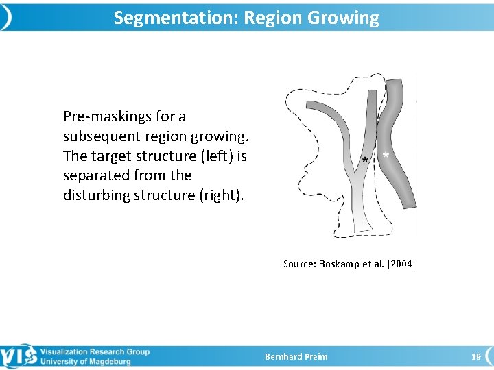 Segmentation: Region Growing Pre-maskings for a subsequent region growing. The target structure (left) is