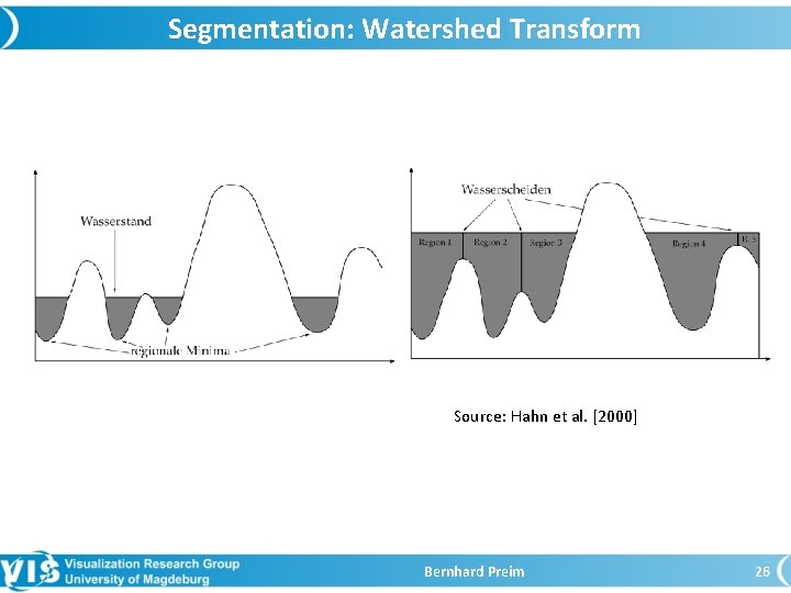 Segmentation: Watershed Transform Source: Hahn et al. [2000] Bernhard Preim 26 