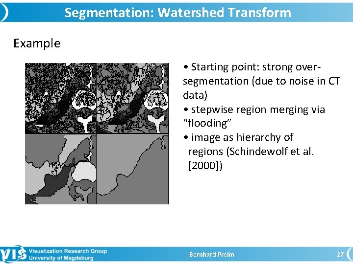 Segmentation: Watershed Transform Example • Starting point: strong oversegmentation (due to noise in CT