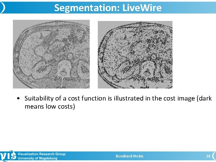 Segmentation: Live. Wire • Suitability of a cost function is illustrated in the cost