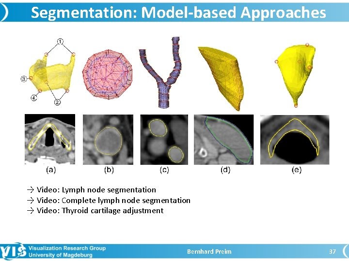 Segmentation: Model-based Approaches → Video: Lymph node segmentation → Video: Complete lymph node segmentation