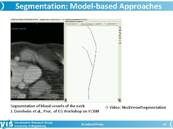 Segmentation: Model-based Approaches Segmentation of blood vessels of the neck J. Dornheim et al.