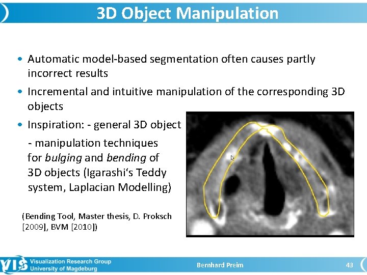 3 D Object Manipulation • Automatic model-based segmentation often causes partly incorrect results •