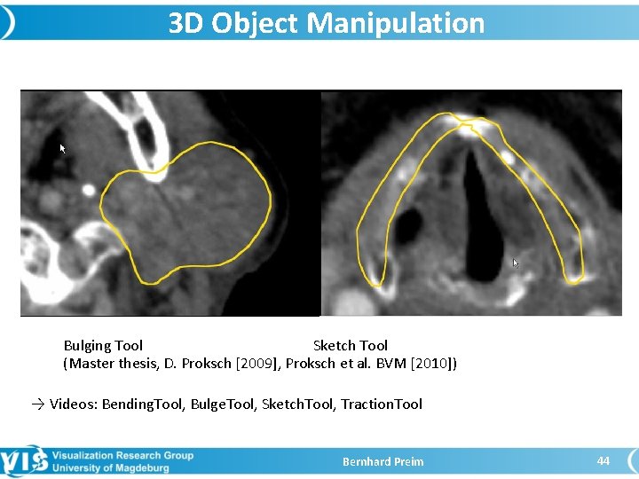 3 D Object Manipulation Bulging Tool Sketch Tool (Master thesis, D. Proksch [2009], Proksch