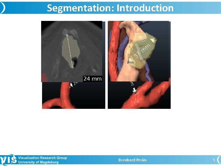 Segmentation: Introduction Bernhard Preim 5 