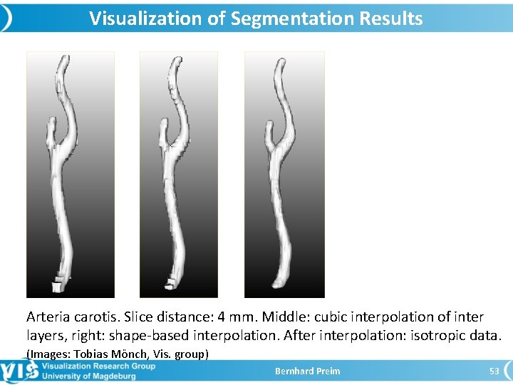 Visualization of Segmentation Results Arteria carotis. Slice distance: 4 mm. Middle: cubic interpolation of