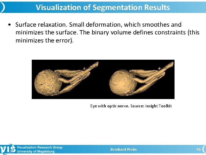 Visualization of Segmentation Results • Surface relaxation. Small deformation, which smoothes and minimizes the