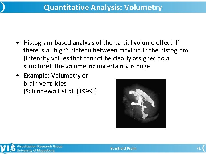 Quantitative Analysis: Volumetry • Histogram-based analysis of the partial volume effect. If there is